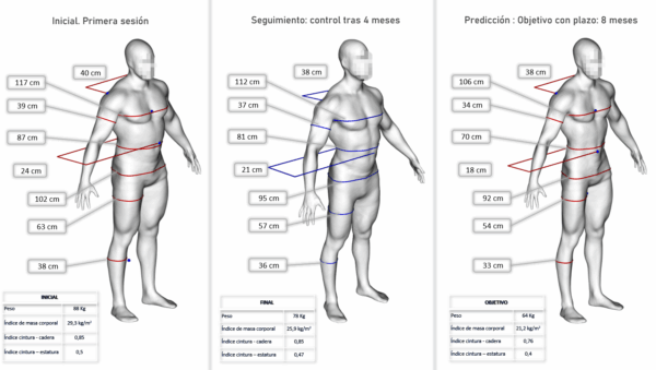 IBV desarrolla desarrolla diferentes proyectos relacionados con la salud utilizando tecnologías como Deep Learning y 3D