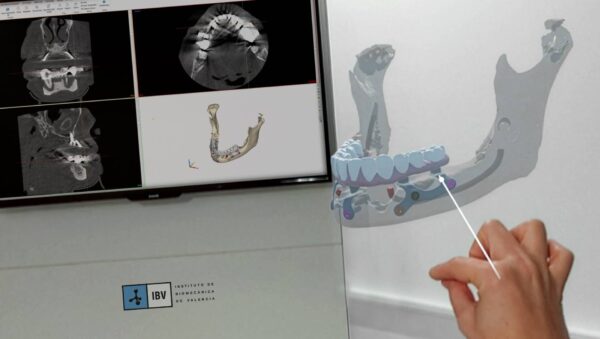 El Centro Tecnológico IBV está desarrollando el proyecto ERGOTWIN y pone en marcha ERGO_MAQUINAS y XR-SURGICAL